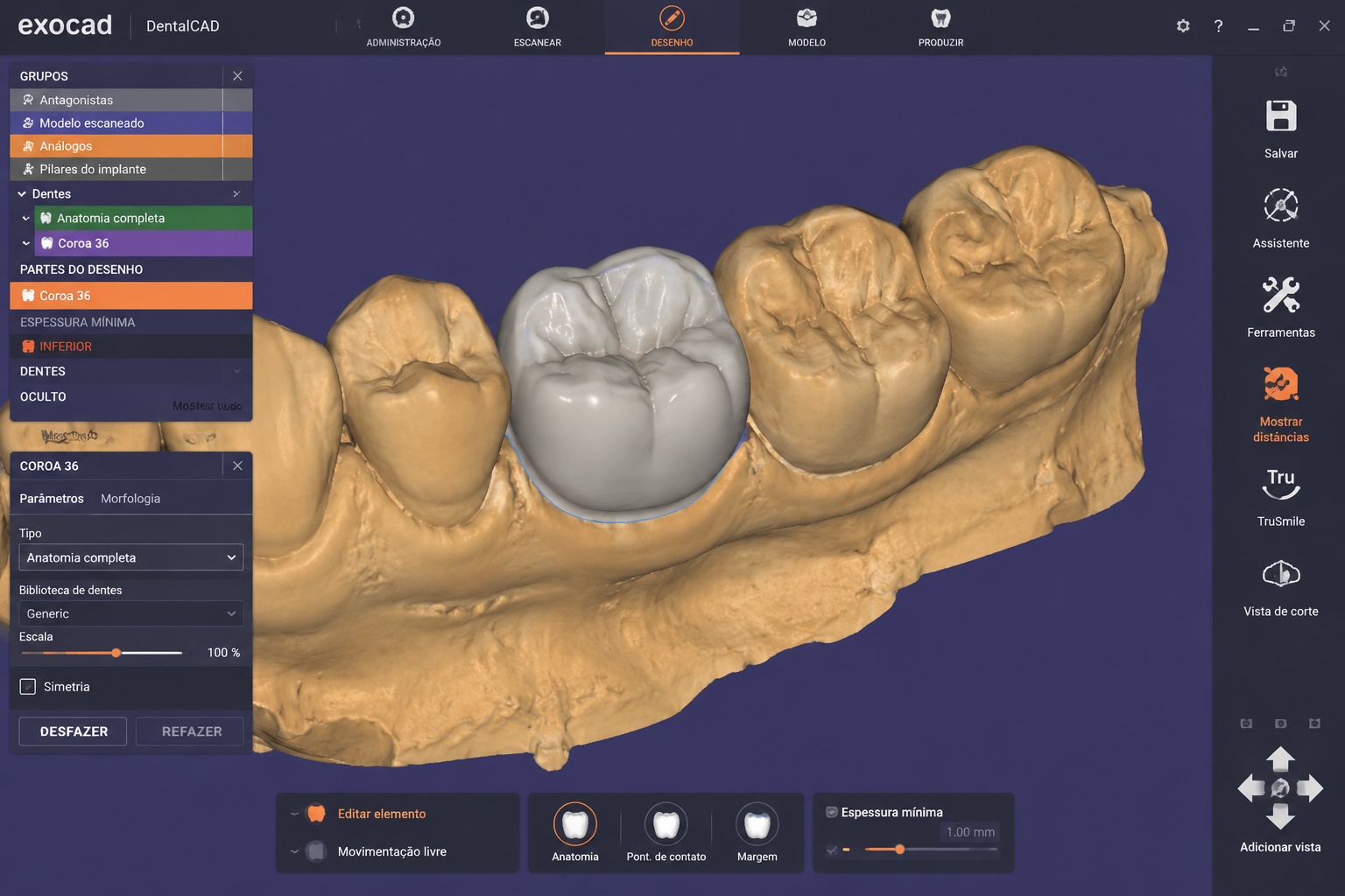 Software de planejamento odontológico 3D Exocad — Constancio Odontologia
